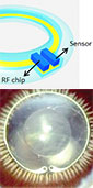 diagram of lens with sensor and RF chip, with image of lens in eye